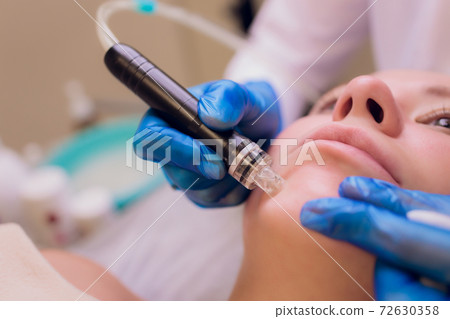 Woman cleaning nose skin pores using vacuum blackhead remover, cosmetic procedure. Woman cleaning nose skin pores using vacuum blackhead remover, cosmetic procedure. 72630358