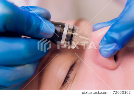 Woman cleaning nose skin pores using vacuum blackhead remover, cosmetic procedure. Woman cleaning nose skin pores using vacuum blackhead remover, cosmetic procedure. 72630362