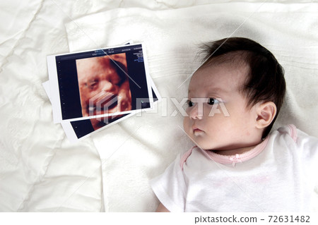 The baby's ultrasound picture and the baby are the same. The baby's ultrasound picture and the baby are the same. 72631482
