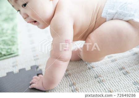 Baby with BCG marks on his arm by the window Baby with BCG marks on his arm by the window 72649286