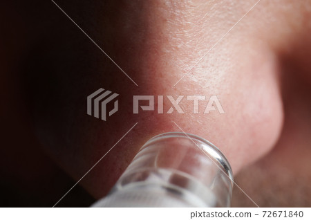 Blackhead skin treatment Blackhead skin treatment 72671840