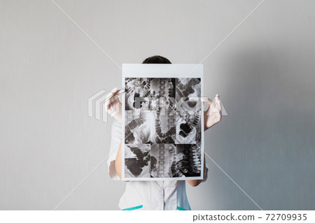 Woman doctor checking the intestine xray of dolichocolon person 72709935