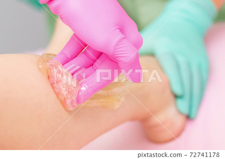 Epilation with liquid sugar on legs. Epilation with liquid sugar on legs. 72741178