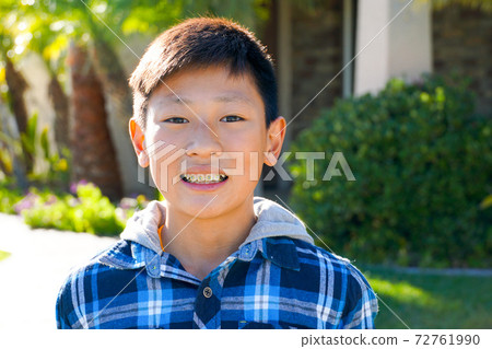 Young teen boy smiling and showing his orthodontic braces on his teeth. 72761990