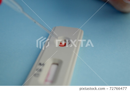 Coronavirus COVID-19 IgM/IgG Rapid Test Kit. covid-19 IGM / IGG antibody diagnostic test in microbiological lab. Coronavirus Coronavirus COVID-19 IgM/IgG Rapid Test Kit. covid-19 IGM / IGG antibody diagnostic test in microbiological lab. Coronavirus 72766477