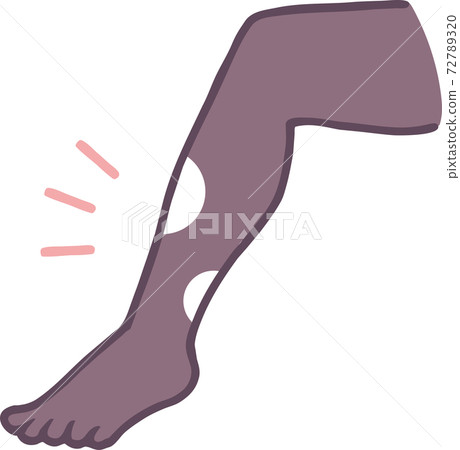 Illustration material of torn tights 72789320