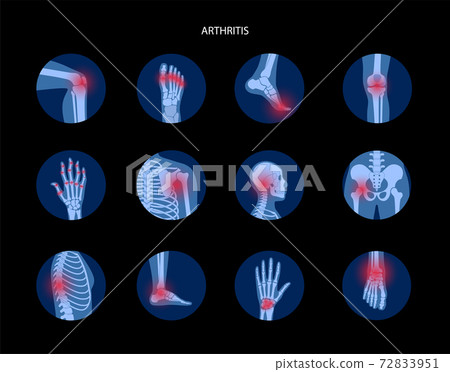 Human bones concept 72833951