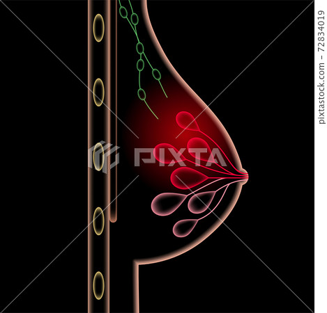 Breast disease concept Breast disease concept 72834019