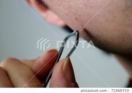 一個男人用鑷子拉出鬍子埋葬的頭髮的特寫 72866559