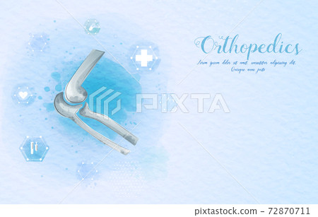 Medical orthopedic watercolor background. Treatment for orthopedics traumatology of elbow bones and joints injury. Medical presentation, hospital. Vector illustration Medical orthopedic watercolor background. Treatment for orthopedics traumatology of elbow bones and joints injury. Medical presentation, hospital. Vector illustration 72870711