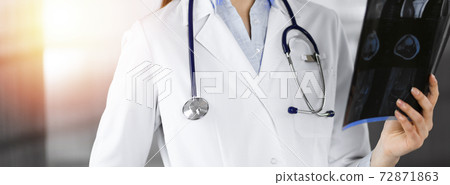 Professional young woman doctor is looking at her patient's roentgenogram in sunny clinic. Medicine concept during Coronavirus pandemic. Covid-2019 72871863