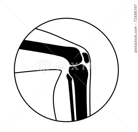 Human Normal Bones 72886397