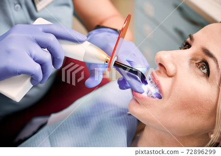 Doctor doing orthodontic procedure with dental laser device. Doctor doing orthodontic procedure with dental laser device. 72896299