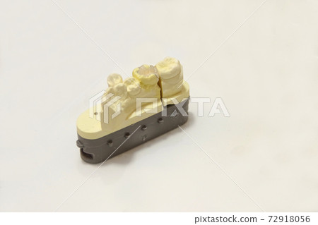Dental ceramic inlay for molars 72918056