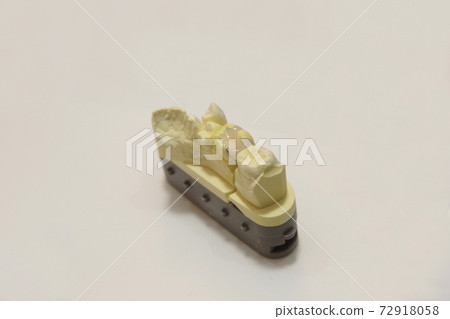 Dental ceramic inlay for molars 72918058