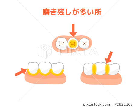 簇絨刷牙膏剩餘 72921105
