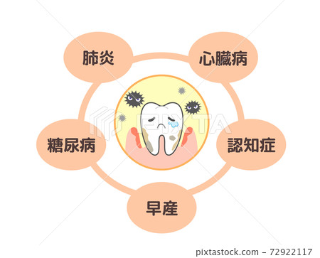 牙周疾病引起的各種疾病:肺炎,糖尿病等 牙周疾病引起的各種疾病:肺炎,糖尿病等 72922117