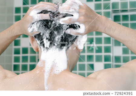 Young man serious hair loss problem for health care medical and shampoo product concept 72924391