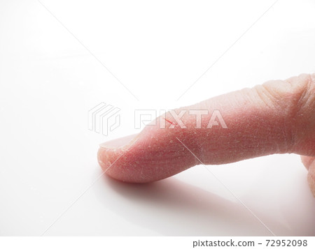 指尖粗到足以裂開 72952098