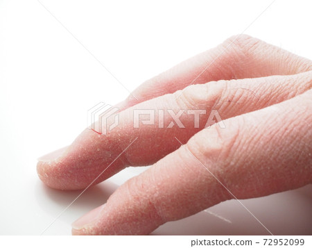 右手的手指粗到足以產生裂縫 72952099