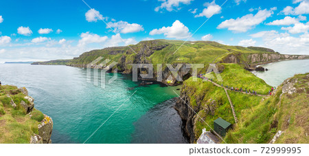 Carrick-a-Rede, Causeway Coast 72999995