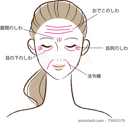 主要皺紋的類型 73002370