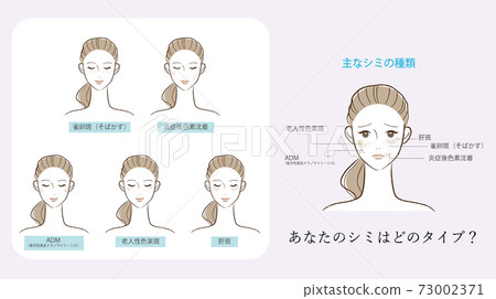 Main types of stains 73002371