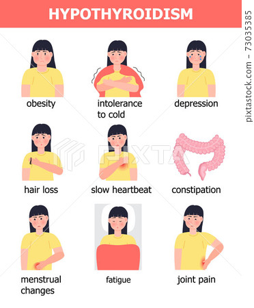 Hypothyroidism medical info-graphic vector. Endocrinology illustration. Symptoms of sick human thyroid gland are shown. Girl with fatigue, obesity Hypothyroidism medical info-graphic vector. Endocrinology illustration. Symptoms of sick human thyroid gland are shown. Girl with fatigue, obesity 73035385