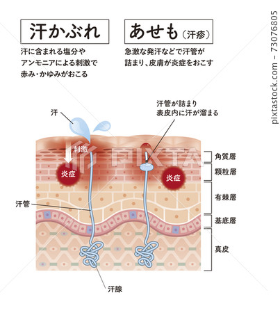 skin, skinned, vector 73076805