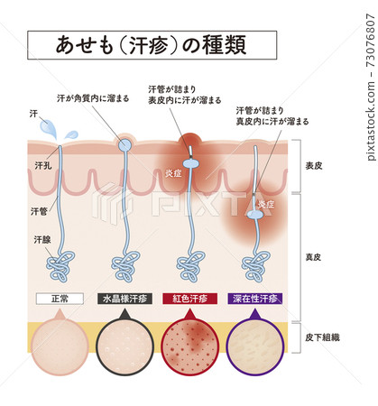 skin, skinned, vector 73076807