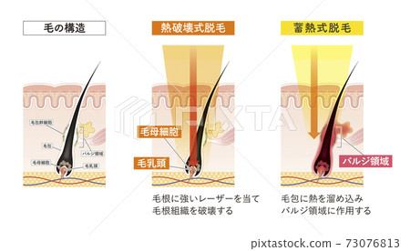 fullbody, cross-section diagram, vector 73076813