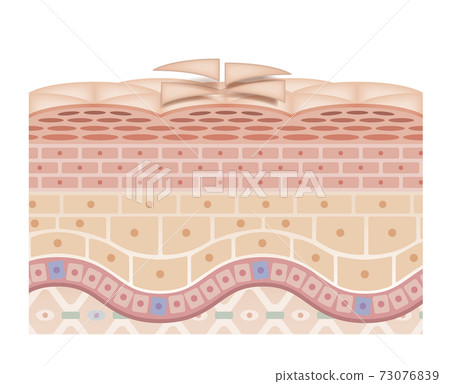 skin, skinned, cross-section diagram 73076839