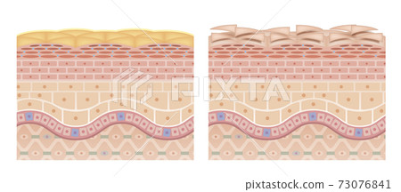 skin, skinned, cross-section diagram 73076841