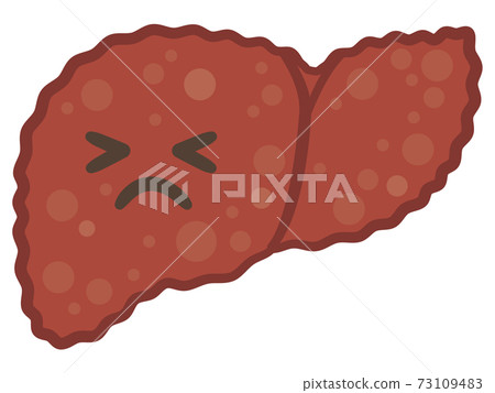 肝硬化的痛苦表情插圖 73109483