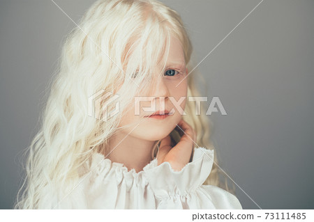 sweet kid portrait natural beauty cute albino girl 73111485