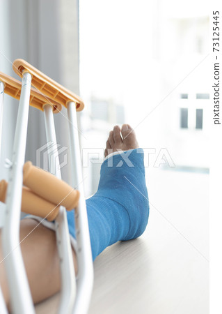 Blue ankle and foot splint Bandages on the legs from a young man's fall accident, Blue plaster on the ankle, Crutches assist in the walking of the patient. 73125445