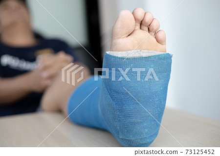 Blue ankle and foot splint Bandages on the legs from a young man's fall accident, Blue plaster on the ankle, Crutches assist in the walking of the patient. 73125452