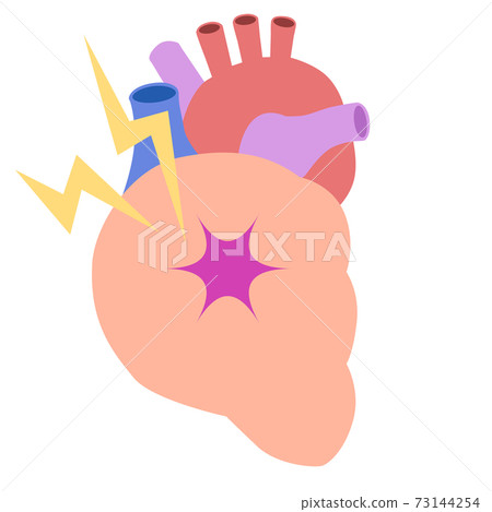 Organ_heart pain 73144254