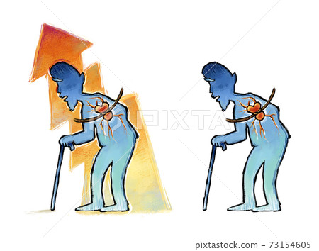 Senile heart disease and high blood pressure 73154605