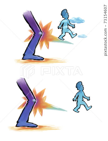Degenerative arthritis 73154607