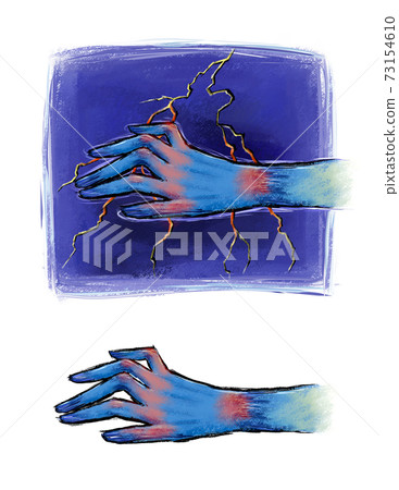 Finger disease and health care 73154610