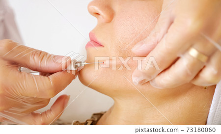 Professional cosmetic surgeon injects young woman cheek 73180060