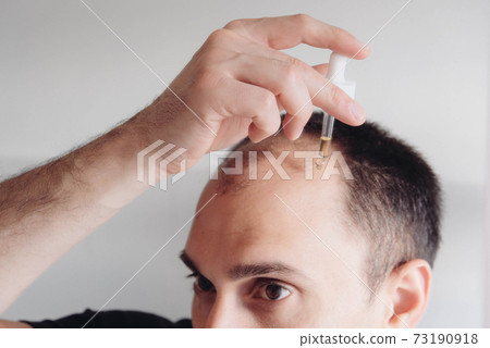 Young caucasian man looking at mirror and applying anti-hair loss concentrate serum. Young caucasian man looking at mirror and applying anti-hair loss concentrate serum. 73190918