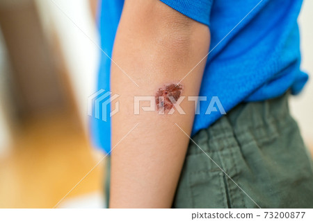 elbow, younger, baby boy 73200877