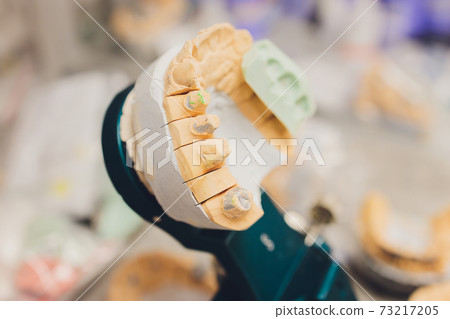 The process of making a dental prosthesis in a dental laboratory. The process of making a dental prosthesis in a dental laboratory. 73217205
