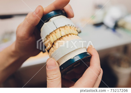 The process of making a dental prosthesis in a dental laboratory. The process of making a dental prosthesis in a dental laboratory. 73217206