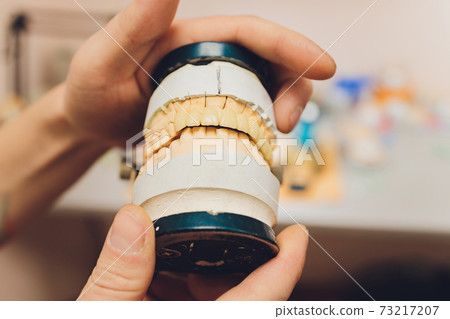 The process of making a dental prosthesis in a dental laboratory. The process of making a dental prosthesis in a dental laboratory. 73217207