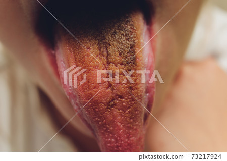 dirty tongue, close-up, dark brown after soda. 73217924