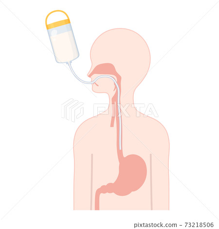 Tube feeding_OE tube illustration_Body cross section 73218506