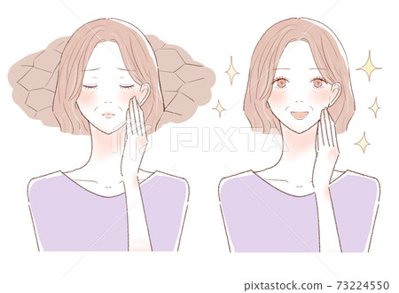 Before and after of middle-aged women suffering from dry skin 73224550